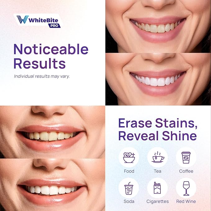 Whitebite Pro Purple Teeth Whitening Strips, 28 Strips (14 Treatments), Enamel-Safe, with Pap, V34 Color Corrector, Hydroxyapatite for Enamel Care, Non-Slip Design