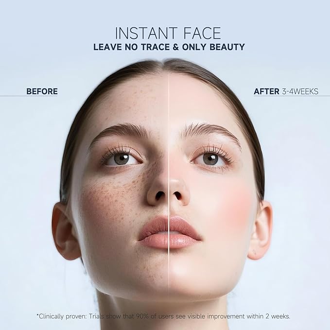 Dark Spot Remover for Face and Body, Corrector Cream, Sun and Age Spot Treatment, Rapid Tone Repair Retinol (1 Fl Oz)