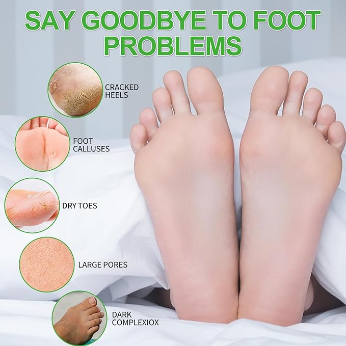 Pedicure Kit Foot Soak Set: Bubble Salt, Sugar Scrub, Massage Mask, Massage Lotion in a Box, 4 Step Foot Spa Kit for Dry Feet,Tired Feet（1 Set Lemon)