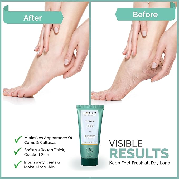 Moraz Caftan Polygonum Foot Cream for Dry Cracked Heels and Feet with 75% Polygonum Extract – Non-greasy, Fast-absorbing Intensive Foot Moisturizer for Dry Cracked Feet, Vegan, Paraben Free, 8.5 Fl Oz
