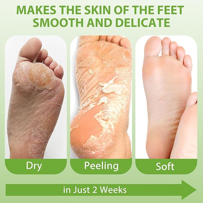 4 Pack Foot Mask, Aloe Vera Hydrating Foot Mask, Deep Exfoliation for Smooth Feet, Foot masks for Removes Dead Skin and Calluses, Nourishing Formula with Soothing Aloe