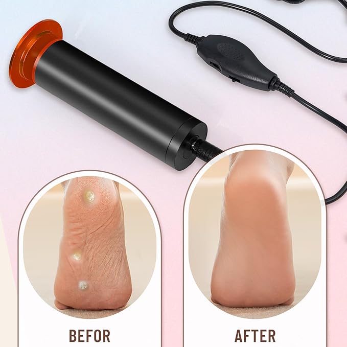Dermawave Electric Foot File Callus Remover for Feet, Professional Foot Scrubber Sander Grinder for Dead Skin Cracked Heel, Pedicure Tool with 60 Sandpaper Discs for Men & Women