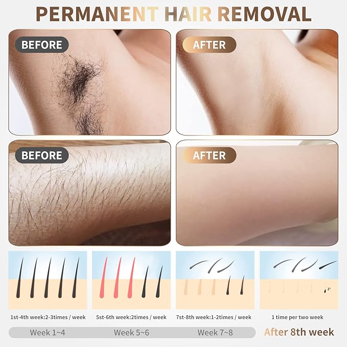 IPL Laser Hair Removal Device for Women & Men - at-Home Painless Ultra-Fast Flash Hair Remover, 86% Hair Reduction in 4 Weeks, High Energy & 5 Modes, 8 Mins Full Body & Bikini Line & More