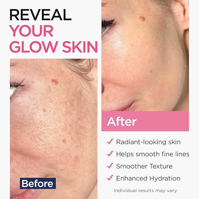 Retinol Serum for Face (8Oz) with Hyaluronic Acid, Vitamin E & Aloe Vera - Anti-Aging Serum