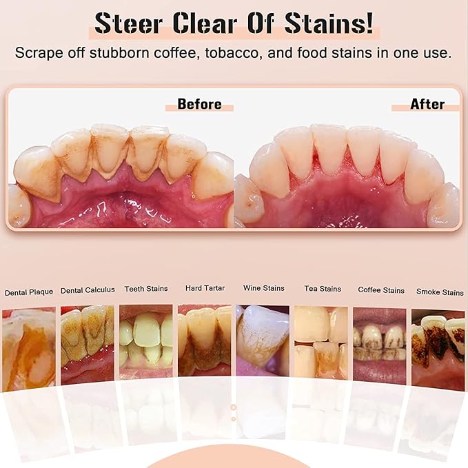 Plaque Remover for Teeth, Electric Tooth Cleaner Tartar Remover for Teeth with LED Light,4 Modes Rechargeable Teeth Cleaning Kit with Dental Tools, 2 Replaceable Heads (White A)