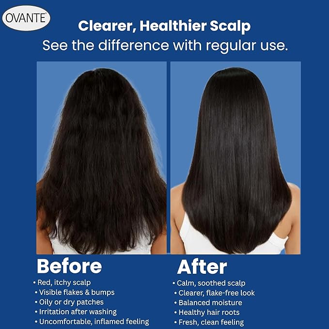 Folliculit Solution Shampoo for Itchy Scalp Treatment & Folliculitis Treatment - Natural Hair Growth & Dry Itchy Scalp Treatment for Scaling, Redness - Folliculitis Shampoo - 6.0 Oz