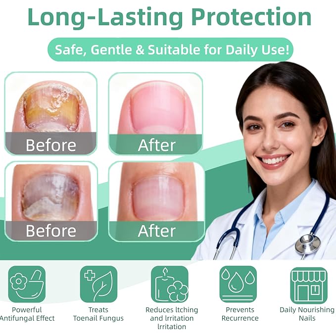 Nail Fungus Pen，Nail Growth & Repair Essence Pen, specifically designed for fungal infections on toenails and fingernails. Repairs and strengthens nails, revealing smooth and glossy nails（3pcs）