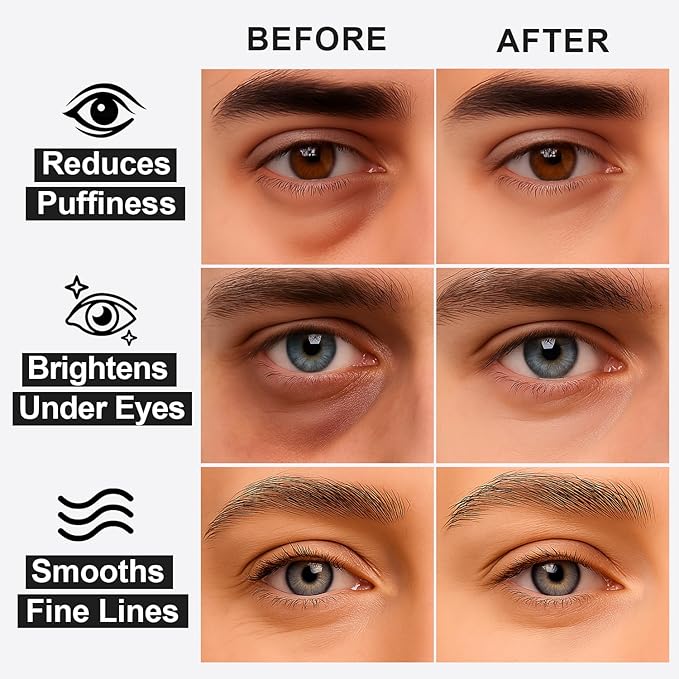 Black Optics Hydrogel Eye Patches 28 Pairs, 5-Min Revitalizing Eye Masks with Caffeine Peptides Black Truffle, Reduce Puffy Eyes Dark Circles & Wrinkles, Luxury Spa Gifts for Men & Women