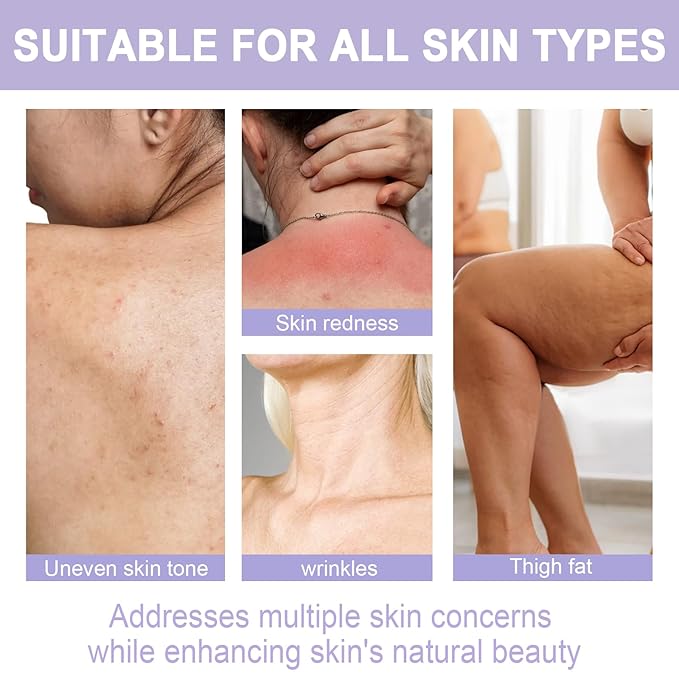 Moon Dream Overnight Toning Whip - Get Body Firming Cream for Women - Age Defying Lift and Frim Cream Helps Target the Appearance of Loose Skin On the Body 6.8 Fl oz