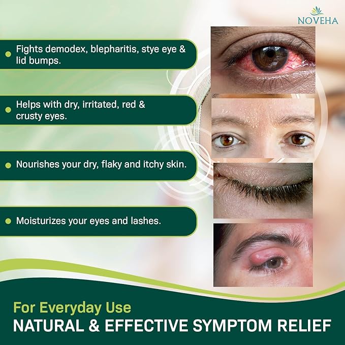 NOVEHA Demodex Eyelid Cleanser Foam | Extra Strength Tea Tree Oil Formula | Daily Face Wash For Eyelash, Demodex, MGD, Stye Eyes, Eye Irritations & Skin Dryness, 3.38 fl oz (3 Pack)