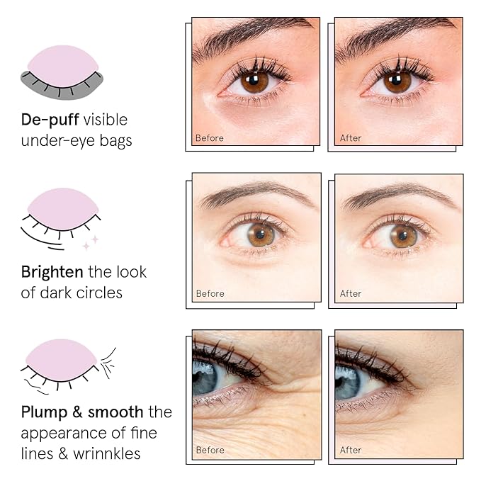 grace & stella Under Eye Patches (12 pairs) Eye Masks for Dark Circles and Puffiness - Stocking Stuffers for Women, Teen Girl Gifts Trendy Stuff, Christmas, Birthdays, Travel & Self Care Gifts