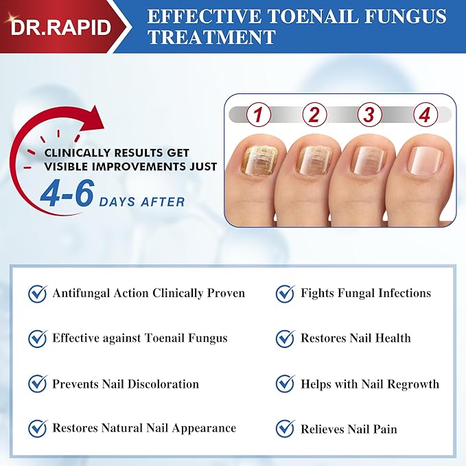 Toenail Fungus Treatment Extra Strength - Effective Antifungal Nail Repair Solution with Tea Tree Oil for Toenail & Nail Fungus, Fast Acting Treatment for Damaged Nails & Ingrown Toenail - 30ml/1fl oz