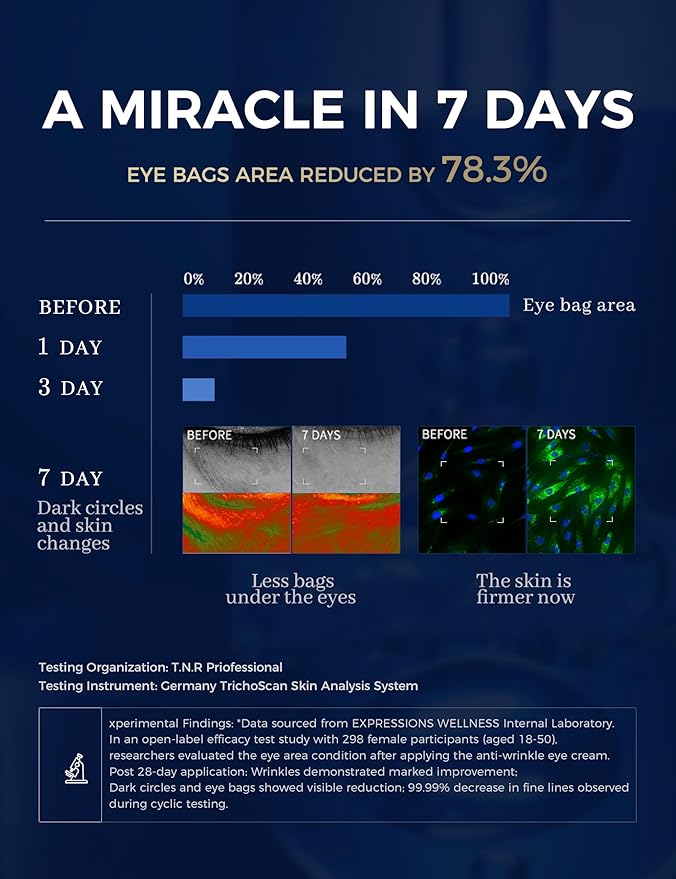 Retinol Eye Cream for Dark Circles with Caffeine Peptides Niacinamide Tranexamic Acid | Under Eye Cream for Puffiness and Eye Bags | Hydrating Firming Korean Eye Care - 1.06 oz