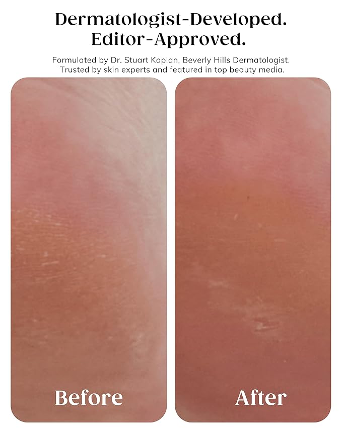 KAPLAN MD Diamond Contour Insta-Glow Gommage Body Peel – Body Exfoliator & Skin Peel with Glycolic Acid, Pineapple Ceramides & Crushed Diamonds - Exfoliating for Smooth, Radiant Skin, 3.4 fl oz