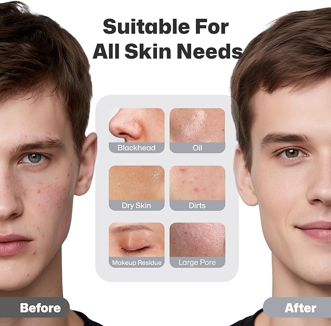 PRITECH Facial Cleansing Brush, Rechargeable Silicone Face Scrubber with Constant-Temperature Heating, Vibrating Exfoliator Scrubber for Deep Pore Cleaning, Waterproof Face Brush for Women & Men-Black