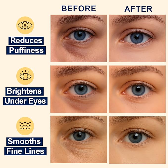 Lunara Under Eye Patches 28 Pairs, 5-Min Energizing Hydrogel Eye Masks with Caffeine Vitamin C Peptides Niacinamide, Refreshing Tired Eye, Includes Two Bonus Eye Serums, Luxury Spa Gifts for Women