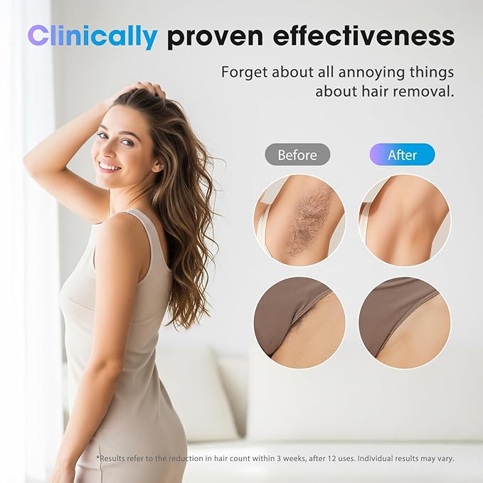 Laser Hair Removal Device, at-Home IPL Hair Removal for Women & Men - Safe 45°F Ice-Cooling Contact for Painless & Long-Lasting Results, 86% Hair Reduction in 3 Weeks for Full Body, Hot Pink