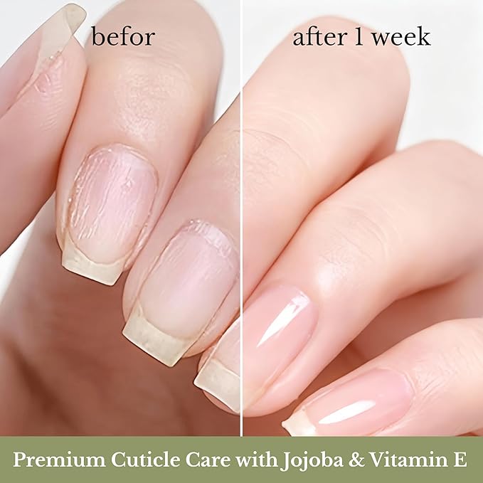 NOVAL Roll on Cuticle Oils for Men & Women, Rollerball Application Luxury Silky Matte Bottle, Fresh Woodsy Cedar Scent, Nail Nourishing & Moisturizing with Jojoba Oil, Natural Ingredients, 0.34fl.oz