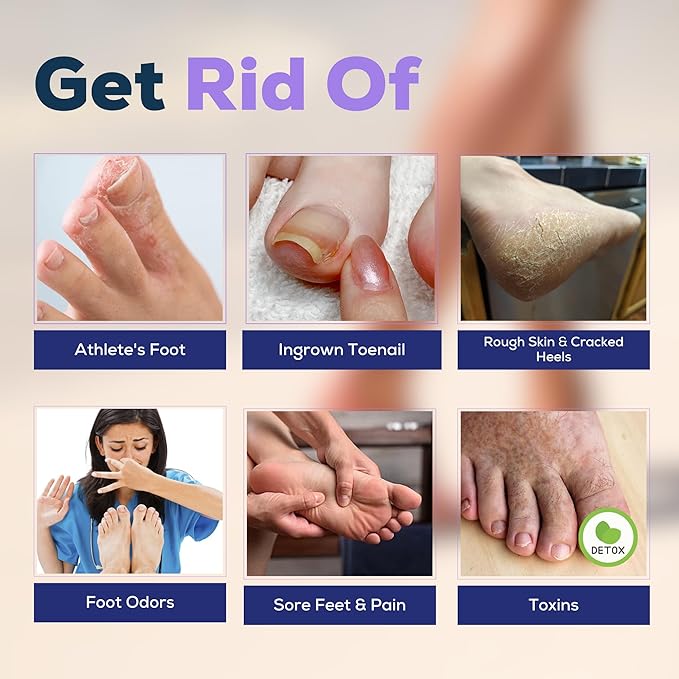 FOOT CURE Soothing Lavender Foot Spa with Epsom Salt Bath Soak – Pedicure Foot Soak Tub & Feet Massager Spa – Relaxing Scrubber & Dead Skin Remover – Ionic Foot Bath Detox for Feet Care (Pack of 1)