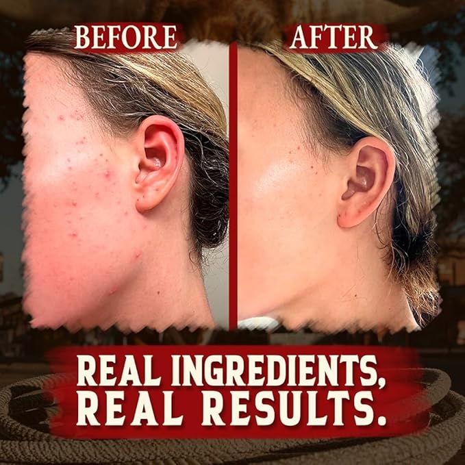 Organic Beef Tallow for Skin - 4 OZ (Pack of 3) — Grass Fed Beef Tallow for face + Body — US-Made Whipped Tallow and Honey Balm Moisturizer for Dry and Sensitive Skin, Eczema, Rosacea (No Additives)