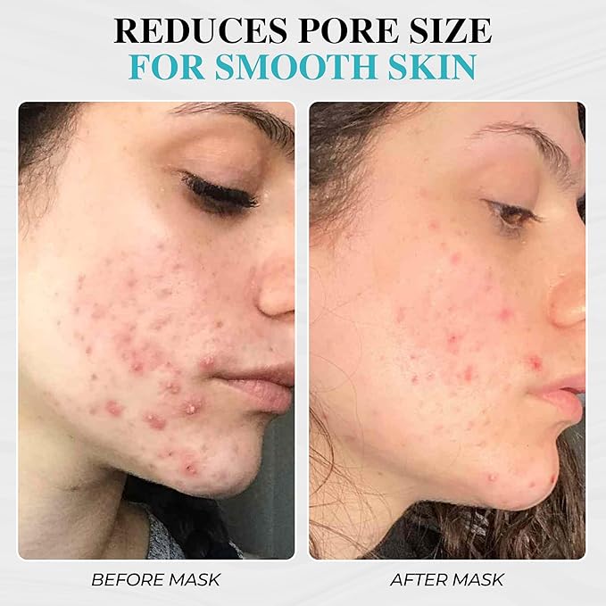 Aromasong Dead Sea Mud Mask with Coconut Oil – 100% Natural Mineral Mud for Face & Body – Hydrating Clay Mask for Pore Cleansing, Acne & Blackhead Removal, Anti-Aging, Firming & Detox