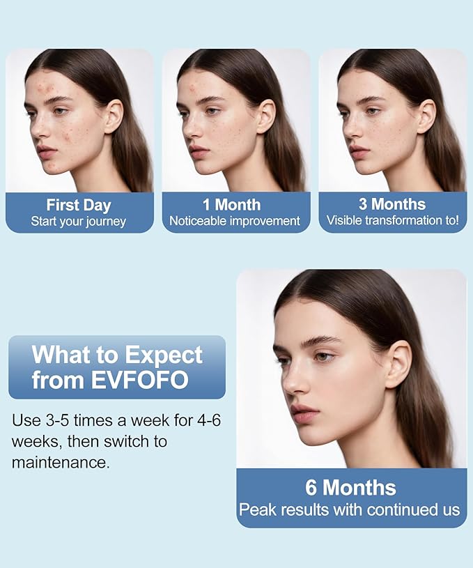 Red Light Photon Facial Mask with Wireless Rechargeable Design, 7 Custom Modes with Infrared, Portable & Rechargeable for Home Use, White