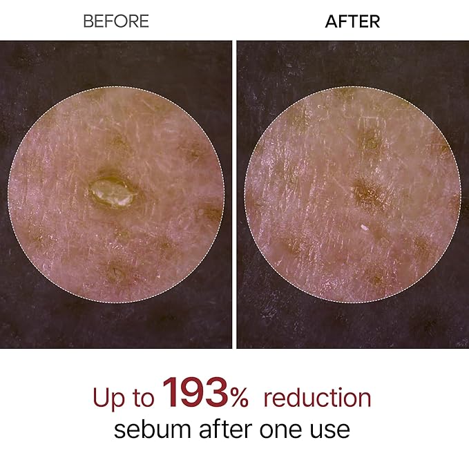 Dr.Melaxin Peel Shot Glow White and Black Rice Ampoule Duo, Soft Exfoliating Face and Body Scrub Dead Skin Cells, Blackheads Remover for All Skin Types