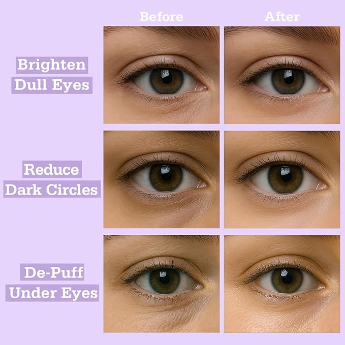 Lavender Hydrogel Under Eye Patches 28 Pairs 5 Minute Calming Hydrating Eye Mask for Puffy Eyes and Dark Circles Relaxing Cooling Under Eye Pads Ophthalmologist Tested