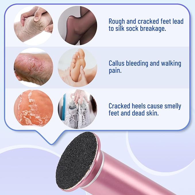 Dermawave 60pcs Replaceable Electric Foot File Callus Remover Sanding Paper Disc Refill Pack for Men & Women, Adhesive Backed, 1.7-Inch, Ultra-Fine 180 Grit