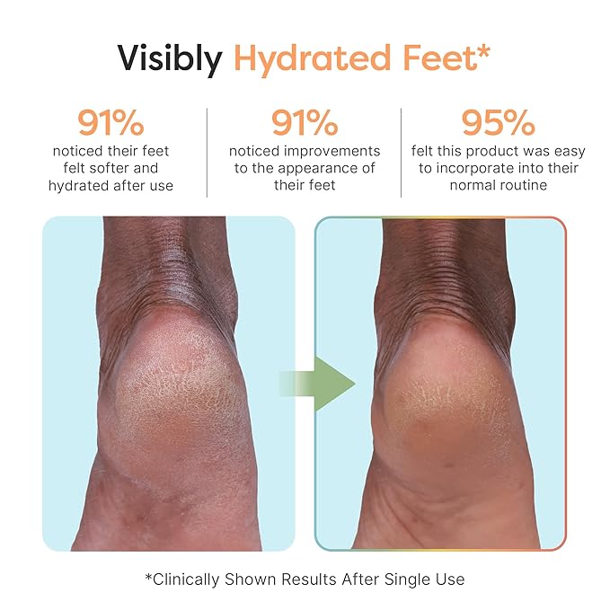 ZenToes Moisturizing Foot Mask for Dry Cracked Feet | Shea Butter, Jojoba Oil & Squalane Infused Hydrating Sheet Masks | Spa Experience At Home | Mess Free Design | Vanilla Citrus Scented, 3 Pairs