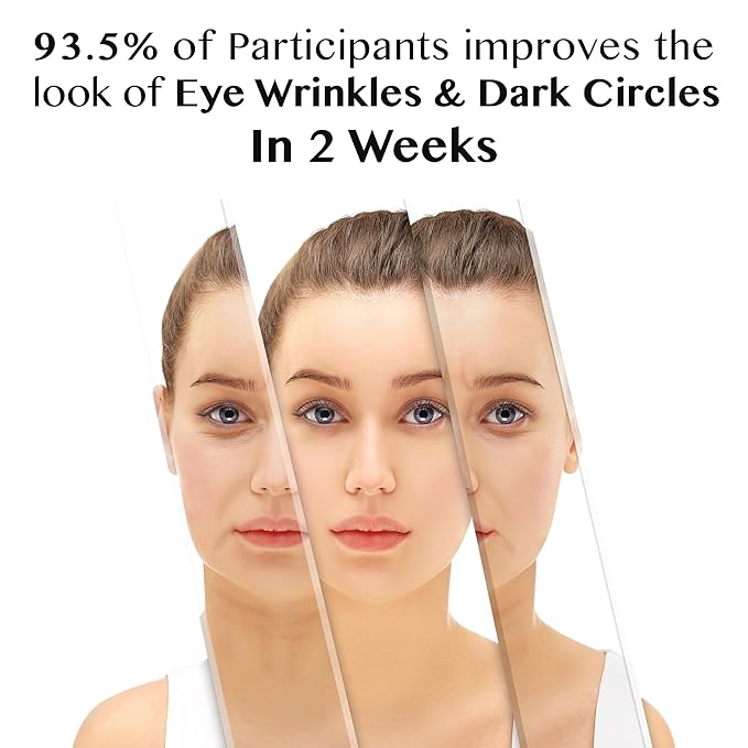 Lamelin Eye Cream Roller, Retinol Niacinamide Vitamin A, Wrinkle & Under Eye Bag & Dark Circle Reducer, Sensitive Skin, Night Cream for Eye Puffiness and Fine Lines, Made in Korea