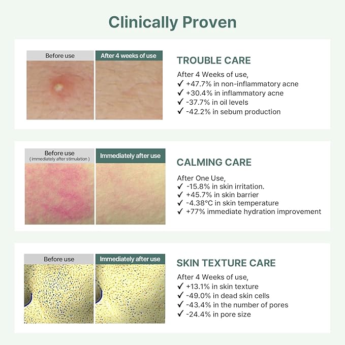 AROCELL Cica Hydrogel Mask 7 Facial Sheet with Panthenol & Centella Asiatica, Transparent Cooling Hydrogel Face Mask for Soothing Calming Hydrating Moisturizing Sensitive Skin Korean Skincare, 25gx7ea