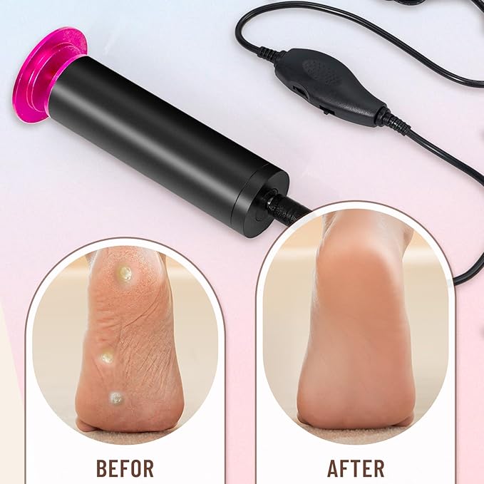Dermawave Electric Foot File Callus Remover for Feet, Professional Foot Scrubber Sander Grinder for Dead Skin Cracked Heel, Pedicure Tool with 60 Sandpaper Discs for Men & Women