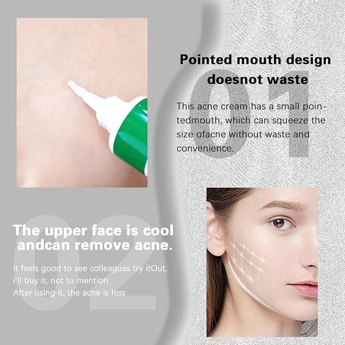 Soothing Cream for Oily & Sensitive Skin – Daily Moisturizer with Niacinamide, Aloe Vera & Hyaluronic Acid for Even-Toned, Radiant Skin, 20g (1PCS,20g)