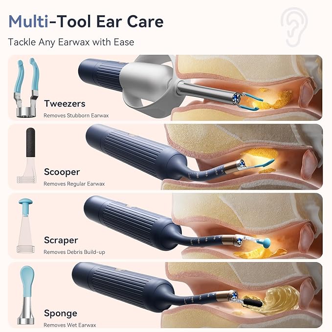 Ear Wax Removal Kit: Upgraded Visual Ear Cleaner with Camera 1080P HD for Adults & Kids - Flexible Ear Wax Remover with 6 LED Lights - Safe Ear Cleaning Tool for Home Use