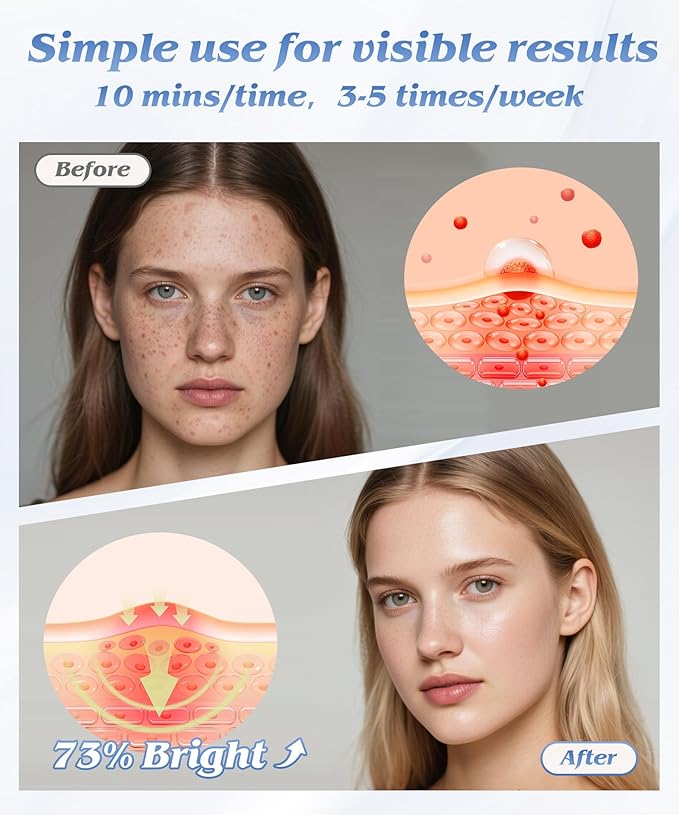 Red Light Therapy Mask for Face, 7 Colors LED Face Mask Light Therapy At Home, Led Face Mask Light Therapy, Black