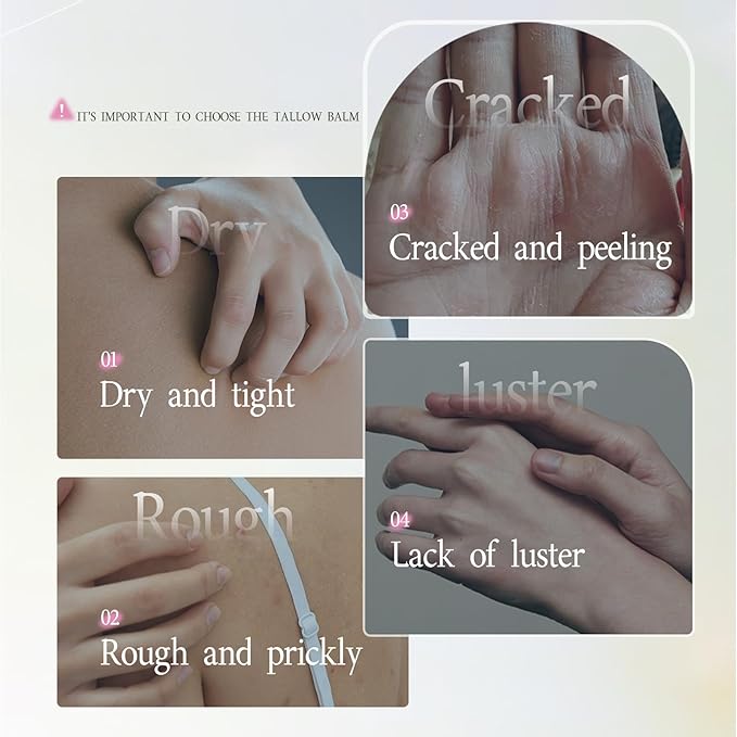 Beef Tallow for Skin - Grass Fed Beef Tallow with Butter,Honey,Jojoba Oil,Body & Face Moisturizer,Deep Nourishment for Dry,Cracked,Sensitive Skin - 5.3OZ