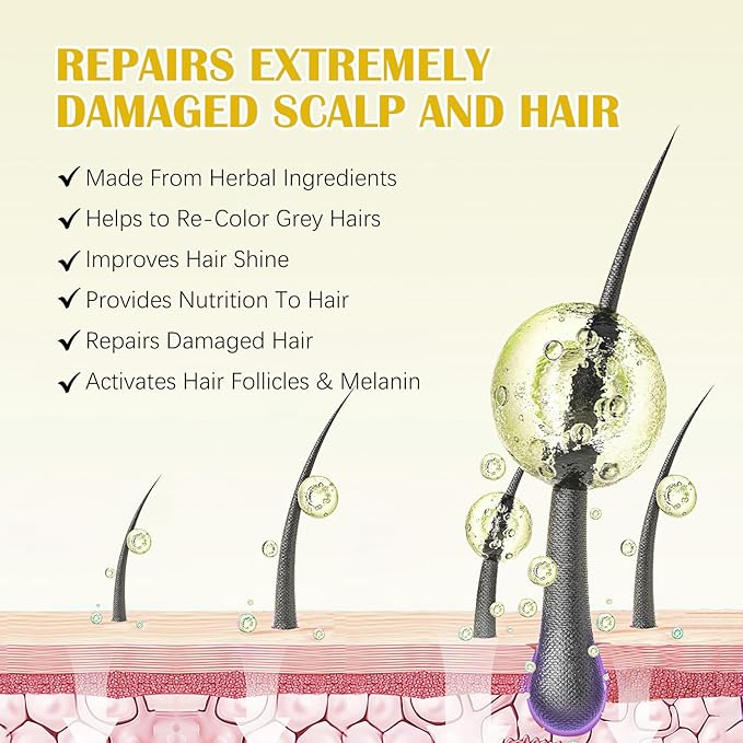 5% Minoxidil for Men and Women with Derma Roller, Hair Growth Serum & Beard Growth Kit, Minoxidil Biotin Hair Regrowth Treatment for Thicker, Fuller Hair - Stop Scalp Hair Loss & Thinning - 2.02 oz