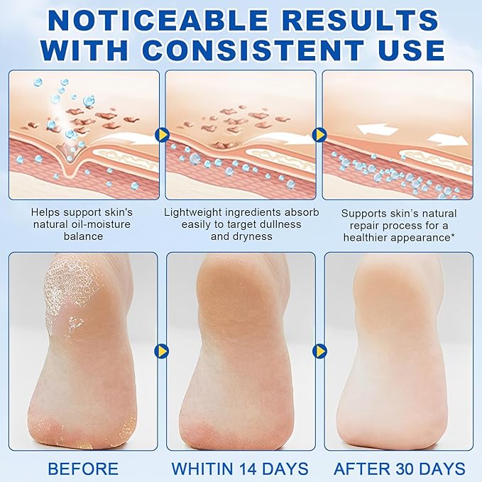 60% Urea with 2% Salicylic Acid Urea Foot Care Stick, Heel Stick for Cracked Feet, Foot Care Cream Moisturizer for Dry Cracked Feet, Knees, Elbows, Hands, Foot Lotion Stick -1.41oz