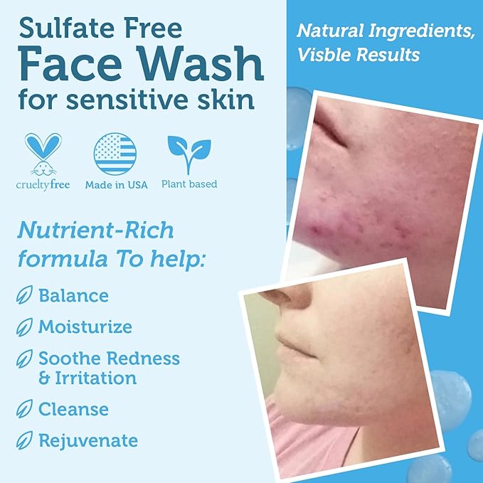 Era Organics Manuka Honey Face Wash for Sensitive Skin - Sulfate Free Gentle Cleanser with Organic Aloe Vera, Hyaluronic Acid & More - Soothing & Moisturizing for Dry Skin - Made in USA (4 oz)