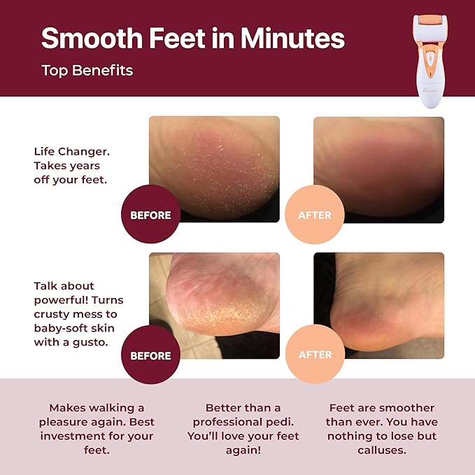 Rechargeable Callus Remover for Feet: Professional Electric Feet Sander for Women by Own Harmony - Electronic Foot File CR900 with 3 Rollers, Foot Grinder Pedi Care for Cracked Heels & Dry, Hard Skin