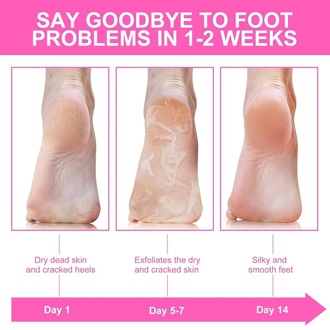 5Packs Foot Mask with Niacinamide, Deep Hydration Foot for Dry Cracked Skin, Nourishing Care with Shea Butter & Vitamin E, SPA at Home, 6.3oz