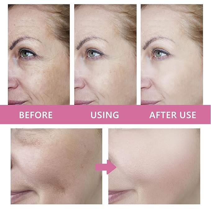 4-in-1 Deep Moisturizing Cream with Retinol & Ceramides - Anti-Aging Face, Neck & Chest Cream - Firming, Wrinkle Reduction for All Skin Types