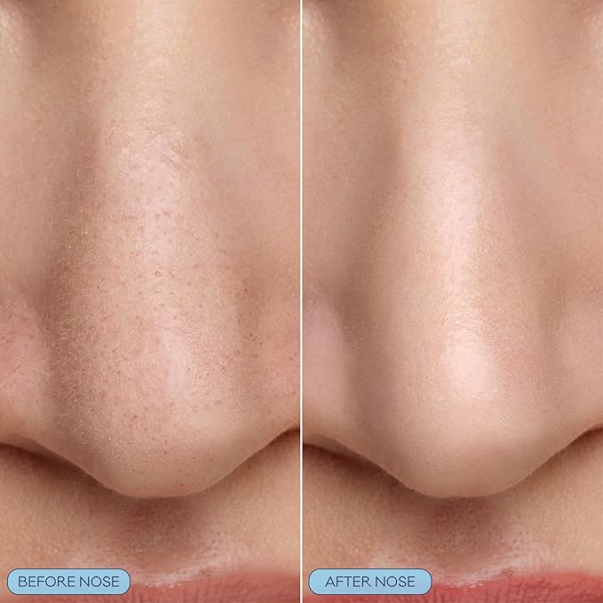 Bioré Pore Refining Bubbling Nose Mask, Glycolic Acid and Hyaluronic Acid Exfoliant for Face, Pore Cleansing Mask, 8 Ct