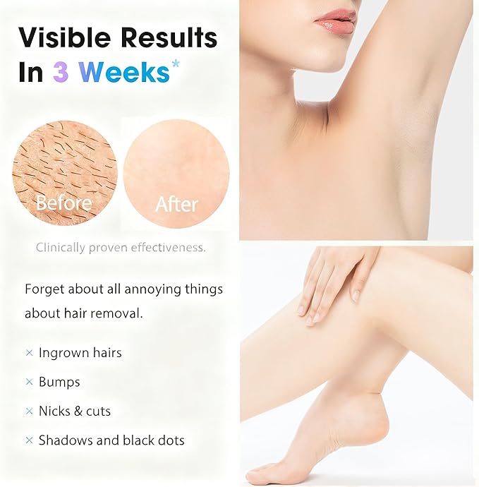 IPL Laser Hair Removal Device for Women & Men - at-Home Painless Ultra-Fast Flash Hair Remover, 86% Hair Reduction in 4 Weeks, High Energy & 5 Modes, 8 Mins Full Body & Bikini Line & More