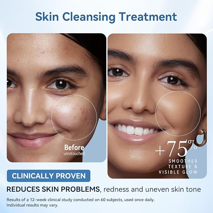 FOLOKE LED Light Therapy Mask Skin Care Mask, LED Red 630±5nm & NIR 830nm Wavelength for Home Use(TAN)