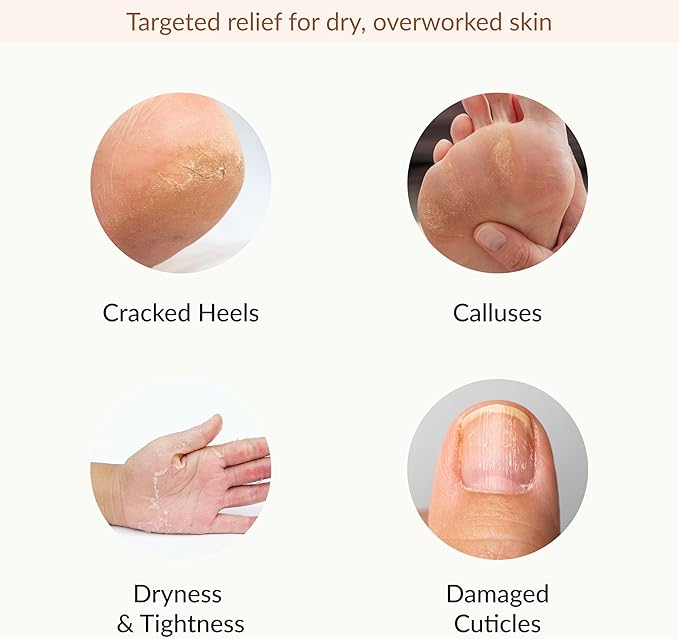 Epielle Hydrating & Moisturizing Hand & Foot Masks for Dry, Rough Skin, Self Care Gifts for Women, Spa Kit, Stocking Stuffers, Thanksgiving Essentials, 6 Moisturizing Gloves & 6 Moisturizing Socks