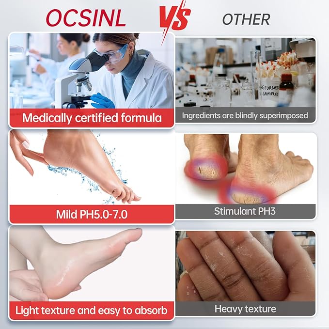 Urea Cream 40 Percent for Feet Maximum Strength, with Heel Protectors, Foot Moisturizer Cream for Dry Cracked Heels Rough Dead Dry Skin Foot Callus Remover - 5.29 Oz