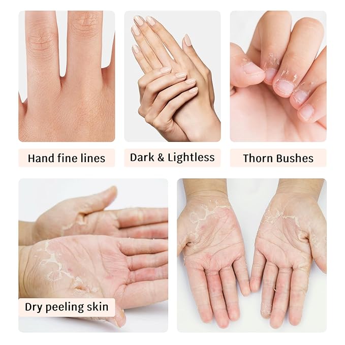 Pairs of 6 Hand Masks Moisturizing Glove,Deep Hydrating Hand Mask Gloves for Dry Hands,Non-Greasy Hand Moisturizer Gloves to Make Hands Soft and Smooth,Spa Set,Hand Care Gifts for Women Set1 (Set1)