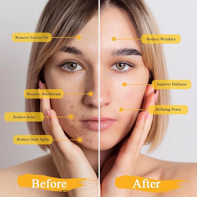 3Pack clay mask, Turmeric Vitamin C, Avocado, Rose clay mask for face, Face Mask Skin Care for Deep Cleaning Reduce Blackheads Dark Spots, Spa Gifts for Women, 3.17 Oz Each